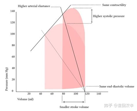 LV常見系列與材質 .